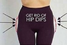 Hip dips